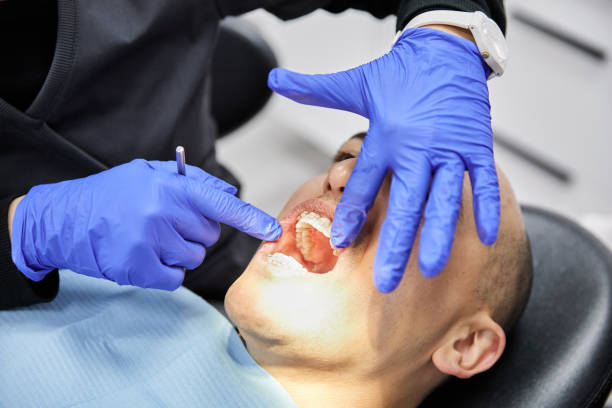 Best Emergency Dentist for Knocked-Out Tooth in Fabrica, TX